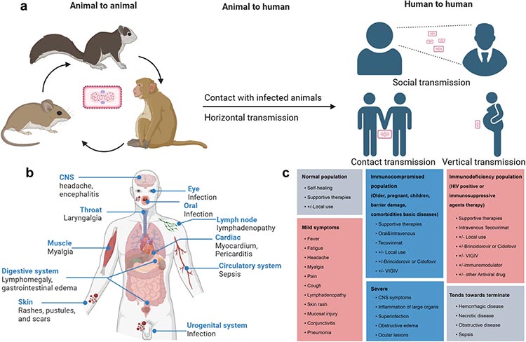 The epidemiological characteristics, pathogenesis, clinical diagnosis, and treatment of Mpox