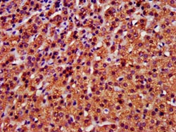 IHC image of A antibody diluted at 1:400