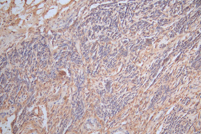 CSB-RA009369MA1HU-IHC