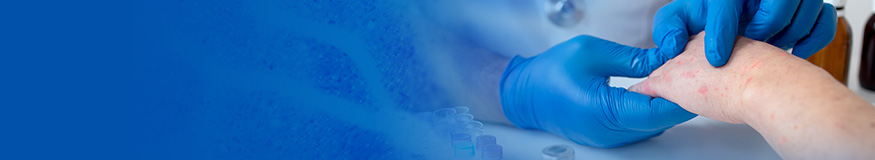 Systemic lupus erythematosus