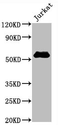 CSB-RA004935A0HU WB