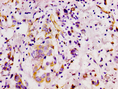 CSB-RA013563A0HU IHC