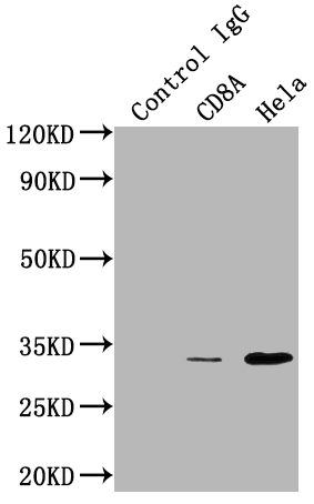 CSB-RA934881A0HU IP