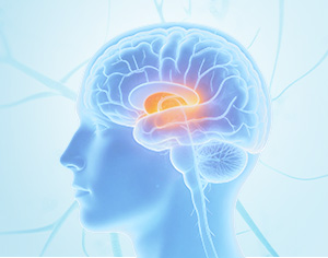 Parkinson's Disease